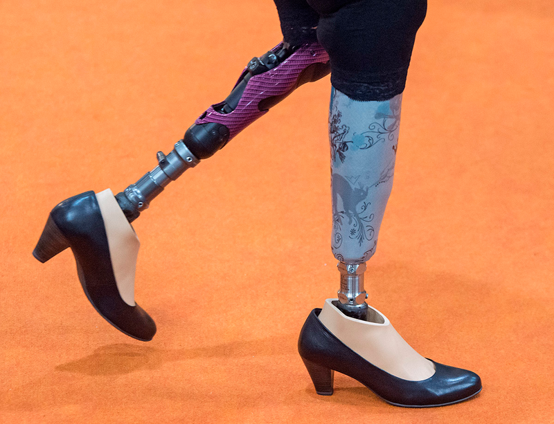 A woman walks with prostheses at the stand of US company Freedom innovations. Image: Jens Meyer/AP